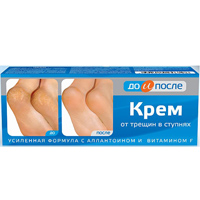 Крем для ног